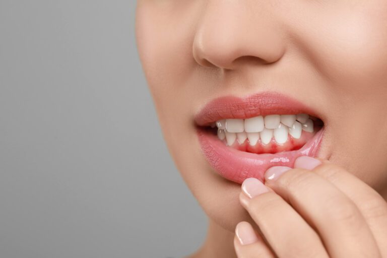 swollen gums